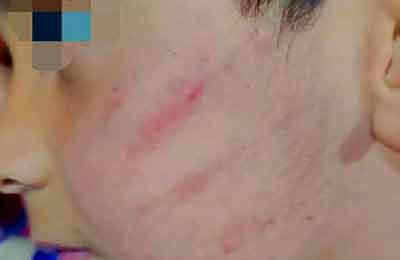 برخورد قاطع با معلم برای تنبیه دانش‌آموز سراوانی